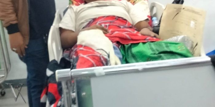 ALDERA Berhasil Menangani Kasus Laka dengan Bantuan RSUD Dr. Soetomo