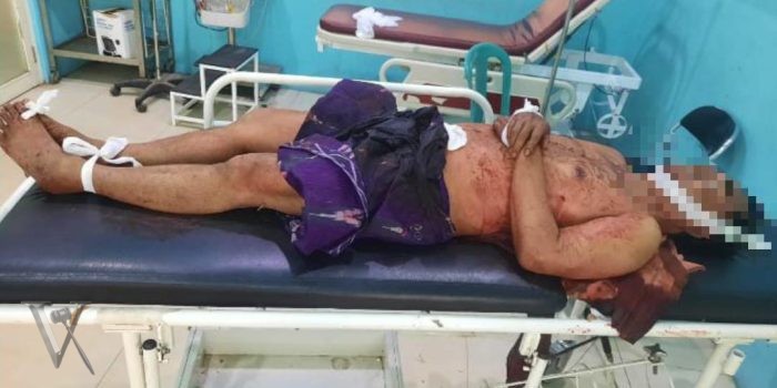 Tragedi Carok di Desa Tanah Merah Laok, Bangkalan: Satu Meninggal Dunia