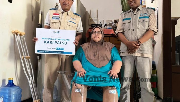 Tak Ingin Berhenti Melangkah, Rara dan Sudamaji Terima Bantuan Kaki Palsu